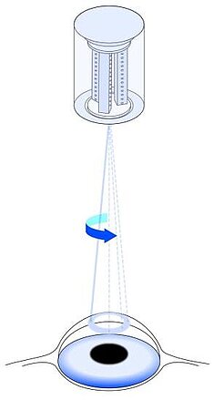 Controlling a laser beam requires maximum precision. Piezo-based nanopositioning systems are ideal for all these applications.