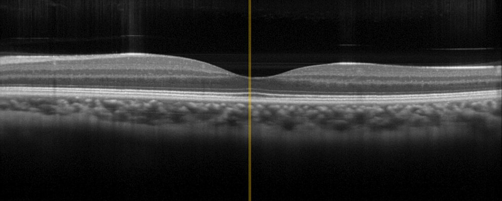 Physik Instrumente OCT Test Image
