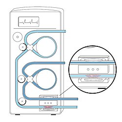 PI Illustration Dialysis